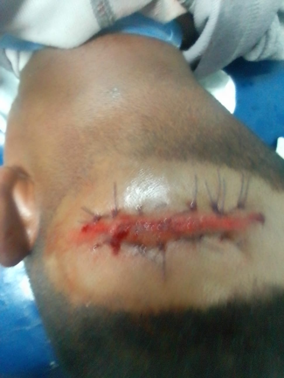 HOSPITAL DO EKUMA | MORTE SUSPEITA DE CIDADÃO ENVOLVE RELAÇÃO EXTRACONJUGAL E FALHAS NO ATENDIMENTO HOSPITALAR